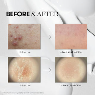 [VT COSMETICS] VT CICA Reedle Shot 100