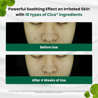 [Doctor.G] Red Blemish Clear Soothing Cream 70ml (2023)