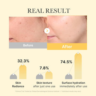 [Medicube] Kojic Acid Turmeric Brightening Gel Mask (4ea)