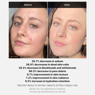 [Medicube] Red Acne Succine Acid Peel 40g