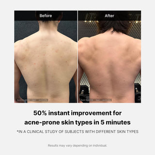 [Medicube] Red Acne Body Wash 2.0 400g