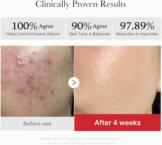 [Medicube] Red Succinic Acid Peeling Pads (70 Pads)