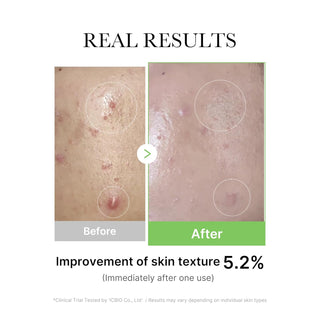 [Medicube] Exosome Cica Ampoule 30ml