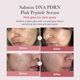 [Medicube] PDRN Pink Peptide Serum 30ml