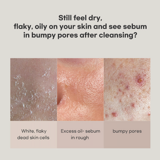 [benetus] Lacto Skin Toner 150ml