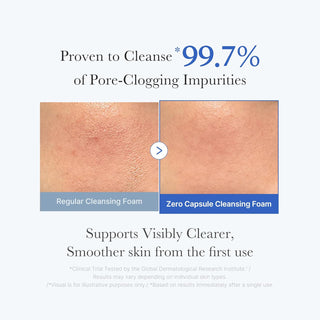 [Medicube] Zero Pore Clear Blue Capsule Cleansing Foam 120g