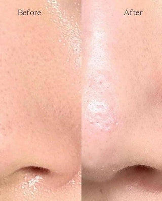 [Ilso] Super Melting Sebum Softener 150ml