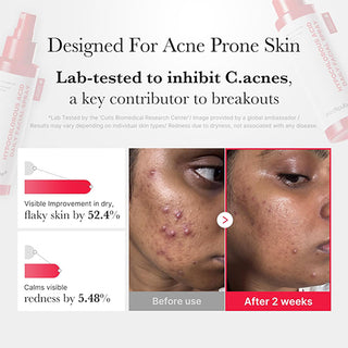 [Medicube] Hypochlorous Acid Daily Facial Spray 125ml